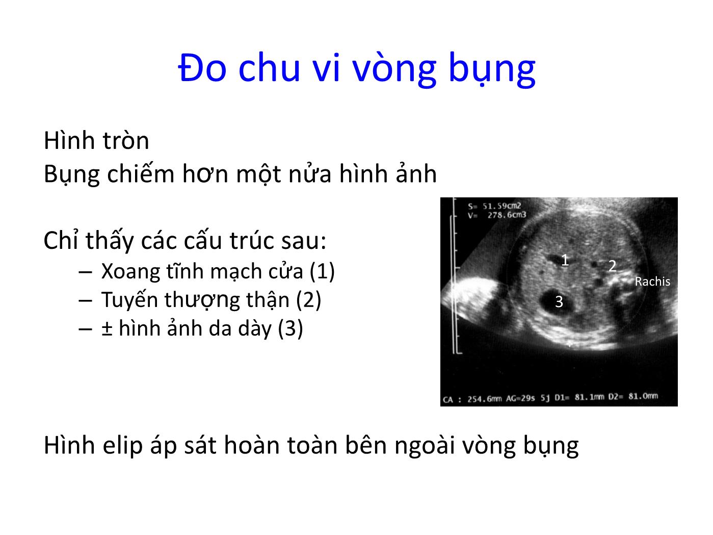 Đề tài Vai trò của siêu âm Doppler trong chẩn đoán và theo dõi thai chậm phát triển trong tử cung trang 10