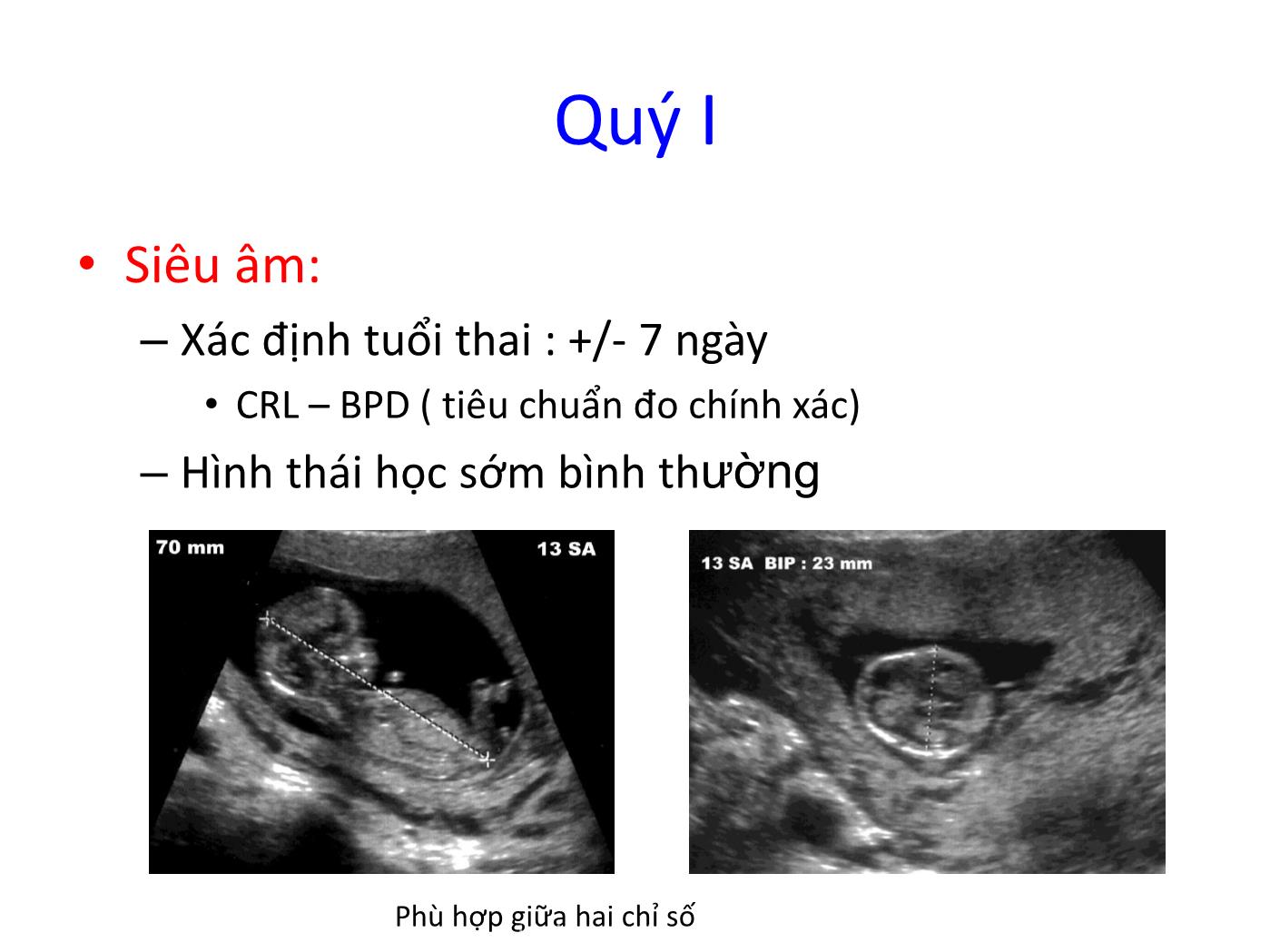 Đề tài Vai trò của siêu âm Doppler trong chẩn đoán và theo dõi thai chậm phát triển trong tử cung trang 2