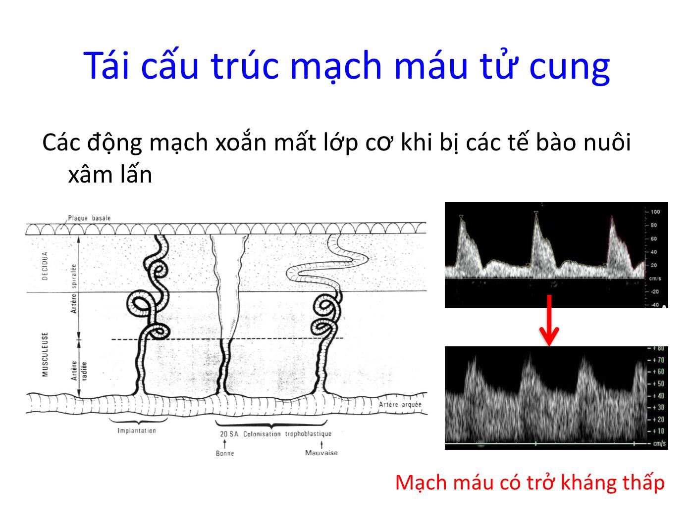 Đề tài Vai trò của siêu âm Doppler trong chẩn đoán và theo dõi thai chậm phát triển trong tử cung trang 4