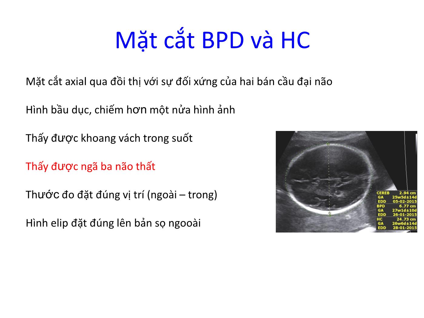 Đề tài Vai trò của siêu âm Doppler trong chẩn đoán và theo dõi thai chậm phát triển trong tử cung trang 9