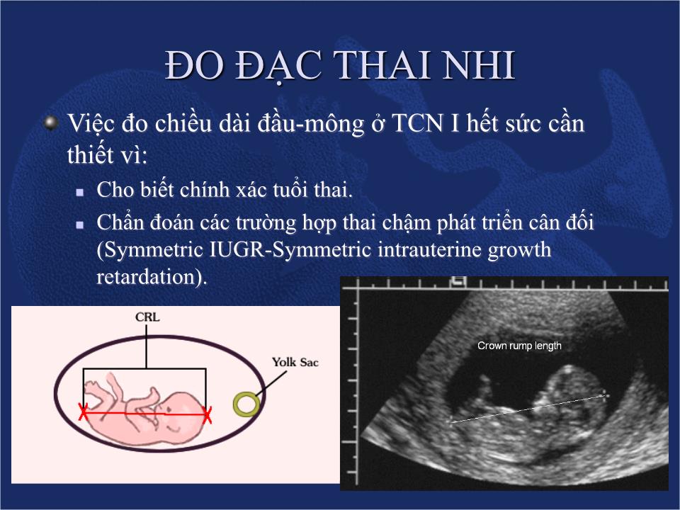 Đề tài Siêu âm chẩn đoán sự sống & sự tăng trưởng của thai - Nguyễn Quý Khoáng trang 7