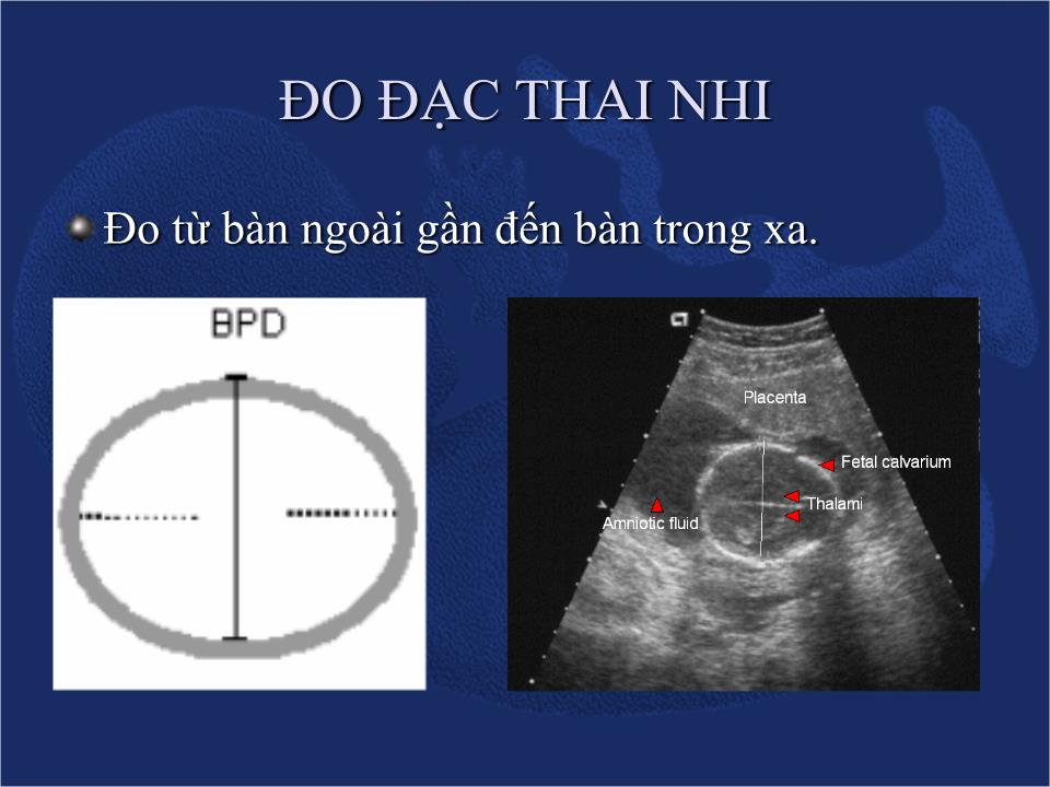 Đề tài Siêu âm chẩn đoán sự sống & sự tăng trưởng của thai - Nguyễn Quý Khoáng trang 9