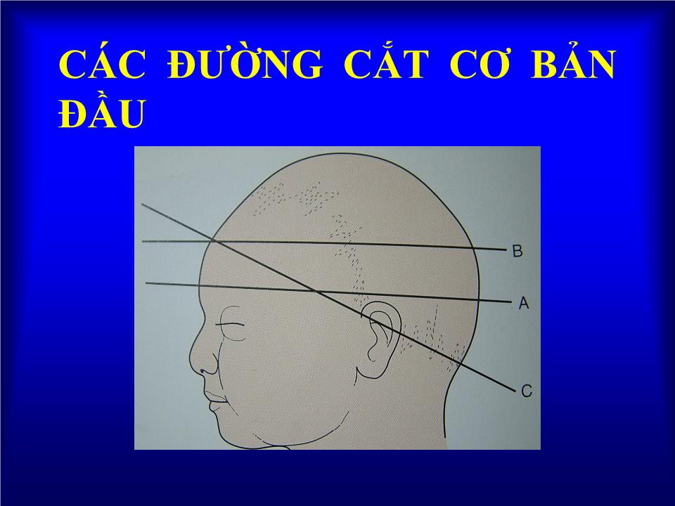 Bài giảng Dị tật đầu - Hà Tố Nguyên trang 5