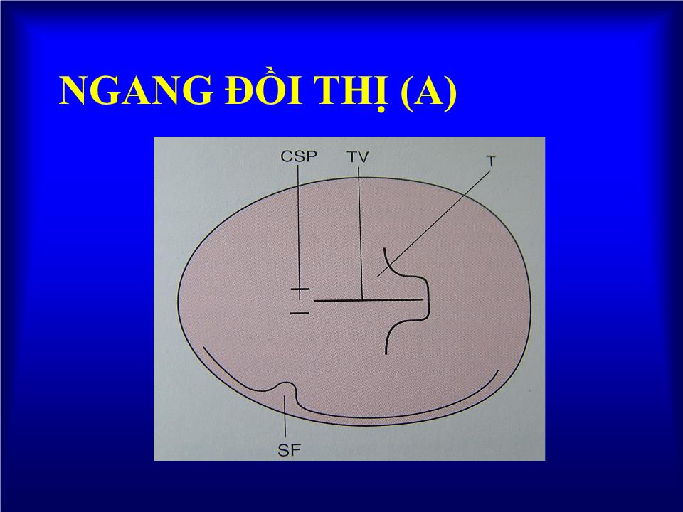 Bài giảng Dị tật đầu - Hà Tố Nguyên trang 6