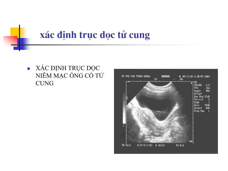 Bài giảng Kỹ thuật siêu âm phụ khoa - Nguyễn Anh Tuấn trang 10