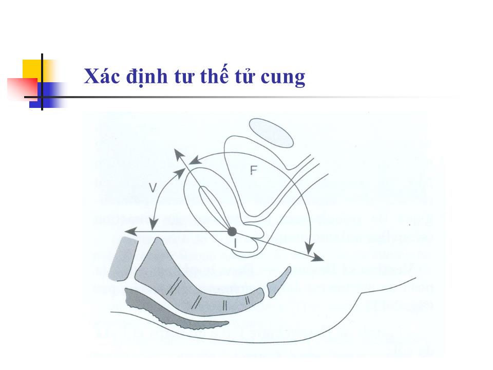 Bài giảng Kỹ thuật siêu âm phụ khoa - Nguyễn Anh Tuấn trang 6