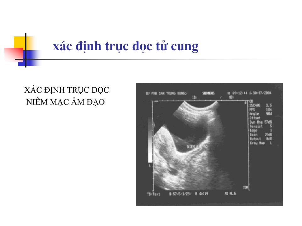 Bài giảng Kỹ thuật siêu âm phụ khoa - Nguyễn Anh Tuấn trang 8