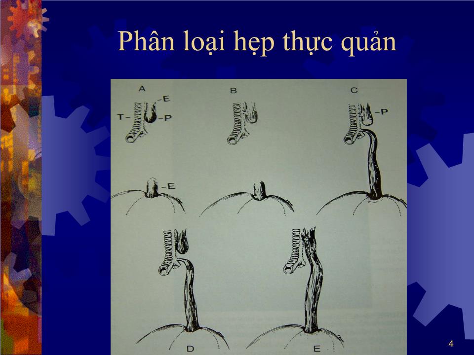 Bài giảng Bất thường ống tiêu hoá - Hà Tố Nguyên trang 4