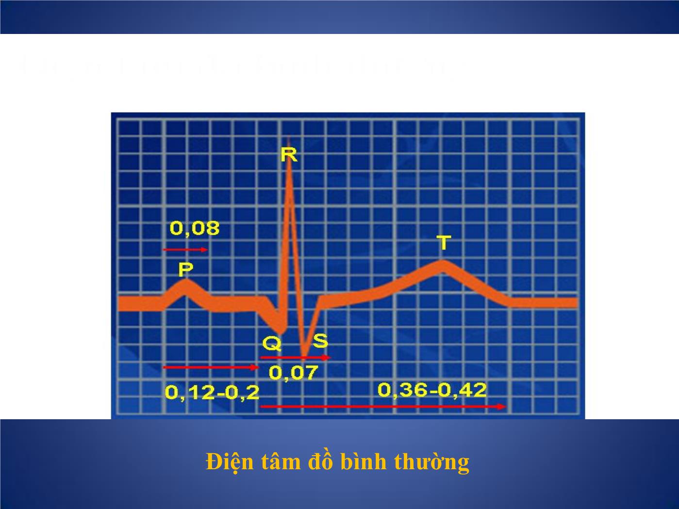 Các phương pháp thăm dò chức năng tim trang 10