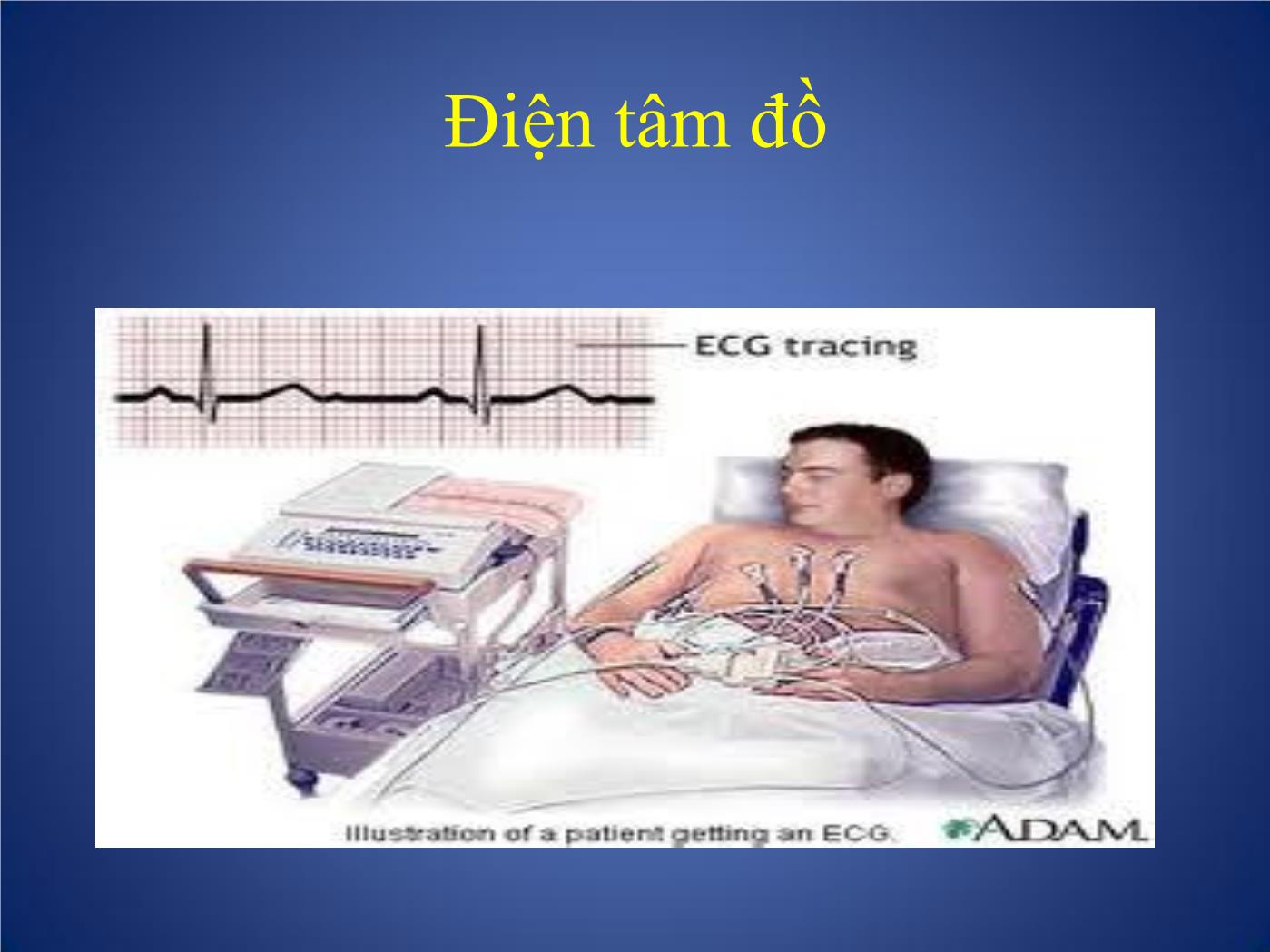 Các phương pháp thăm dò chức năng tim trang 4