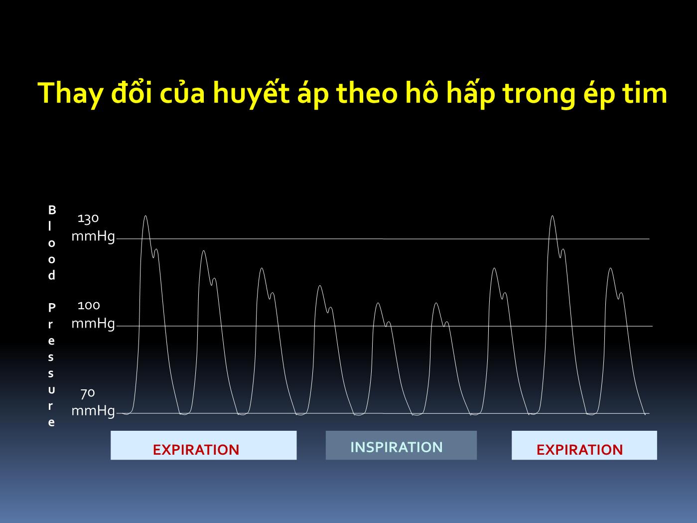 Bài giảng Cấp cứu tràn dịch màng tim gây ép tim - Hoàng Việt Anh trang 9