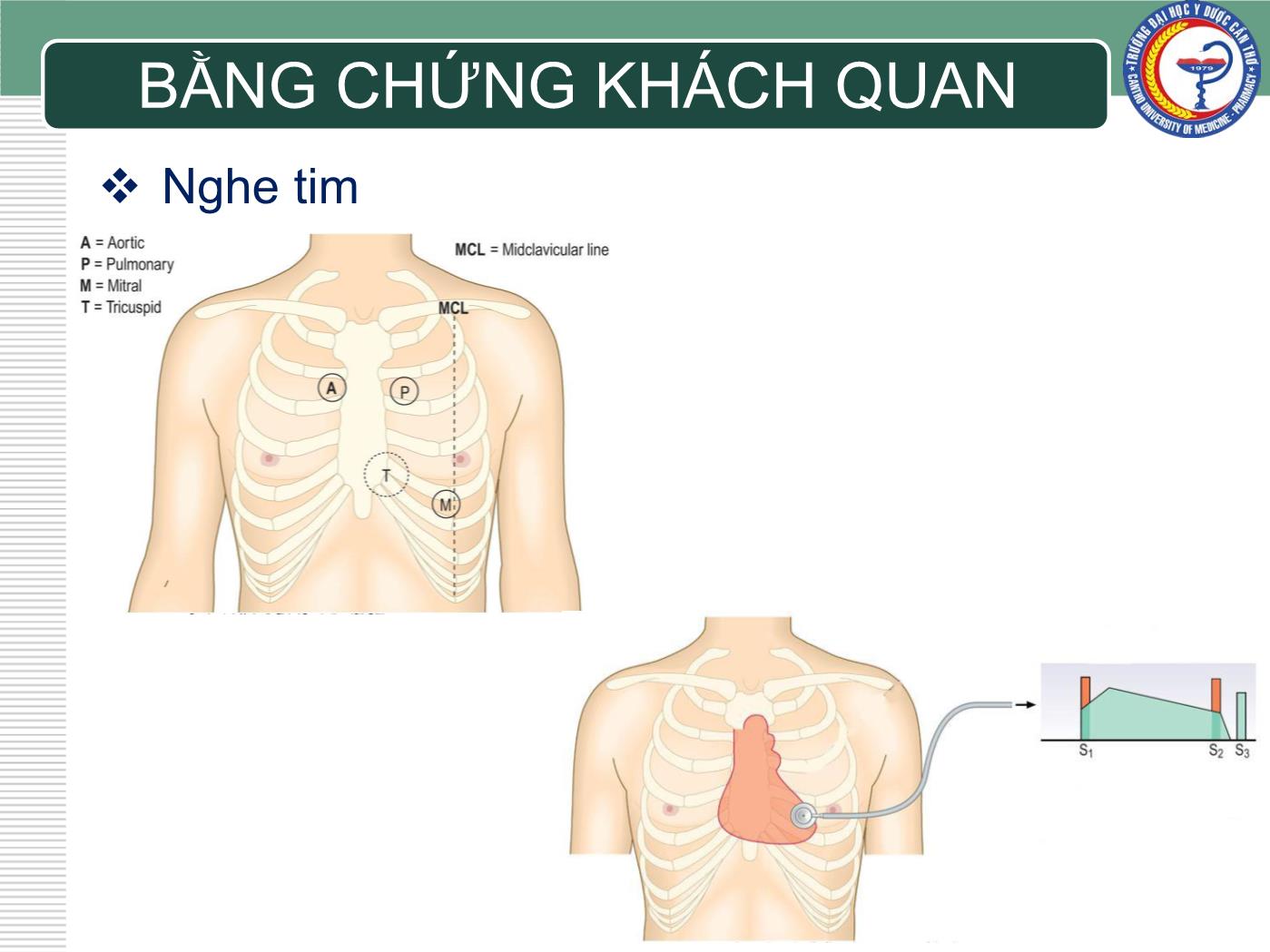 Bài giảng Chẩn đoán và điều trị suy tim - Trần Viết An trang 10