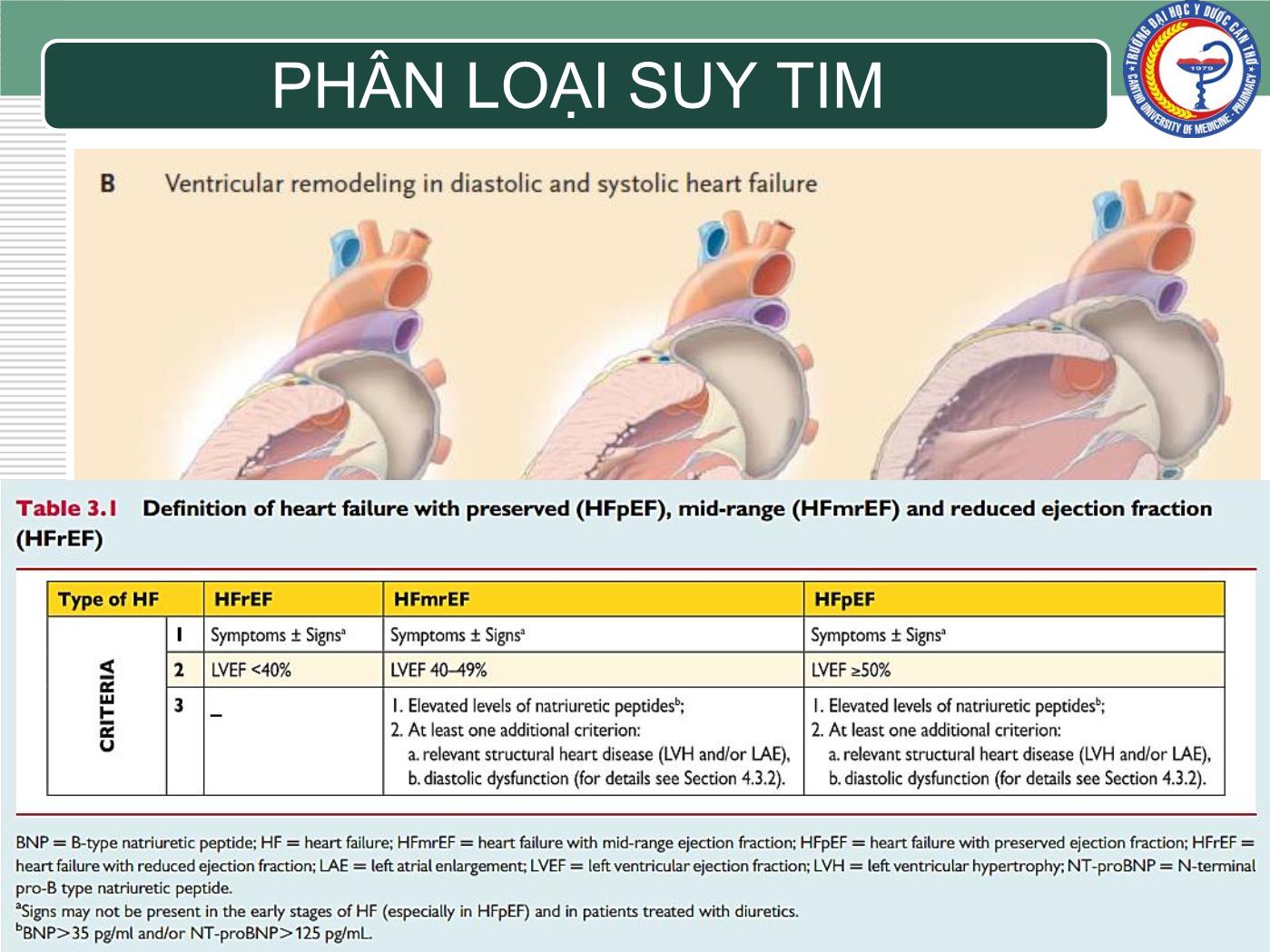 Bài giảng Chẩn đoán và điều trị suy tim - Trần Viết An trang 3