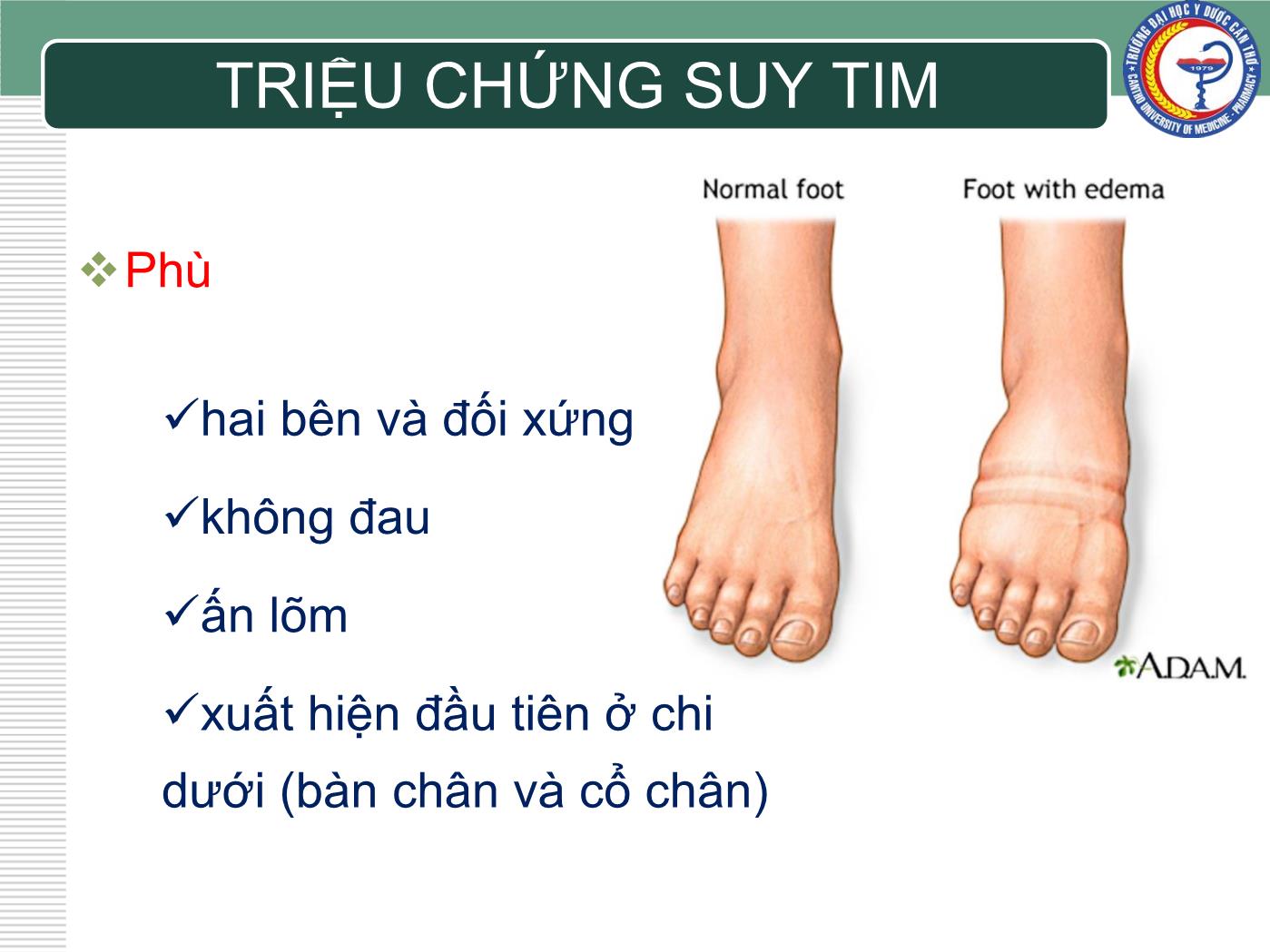 Bài giảng Chẩn đoán và điều trị suy tim - Trần Viết An trang 7