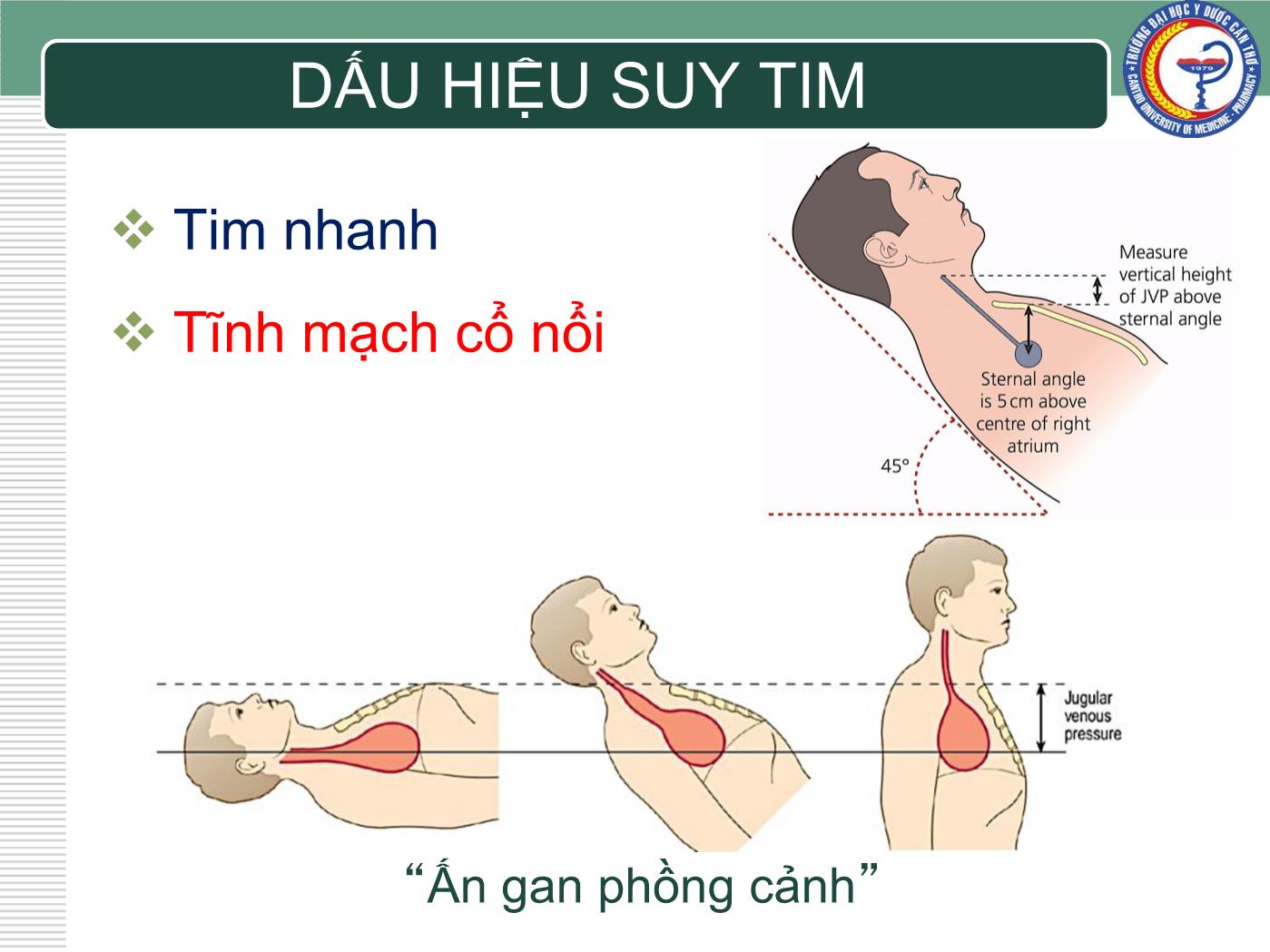 Bài giảng Chẩn đoán và điều trị suy tim - Trần Viết An trang 8