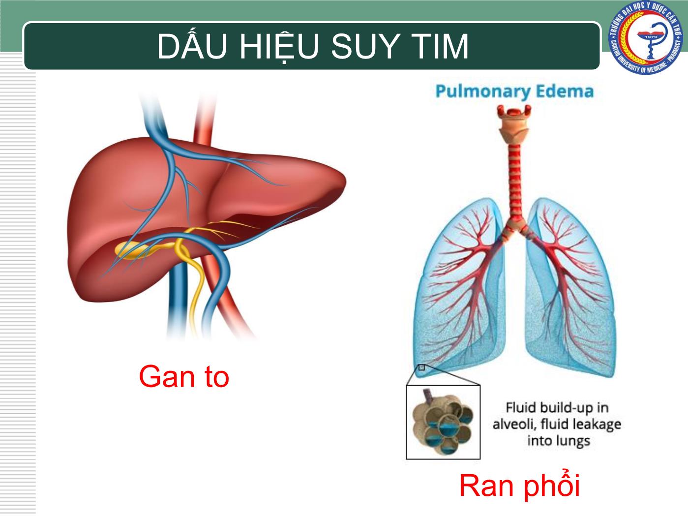 Bài giảng Chẩn đoán và điều trị suy tim - Trần Viết An trang 9