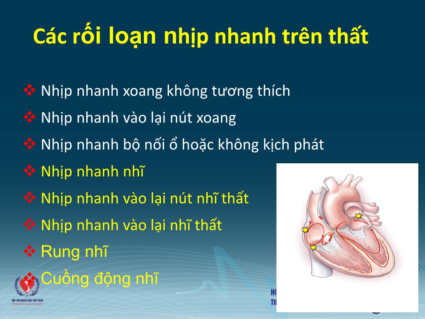 Chẩn đoán và xử trí các rối loạn nhịp cấp tính - Trần Văn Đồng trang 3