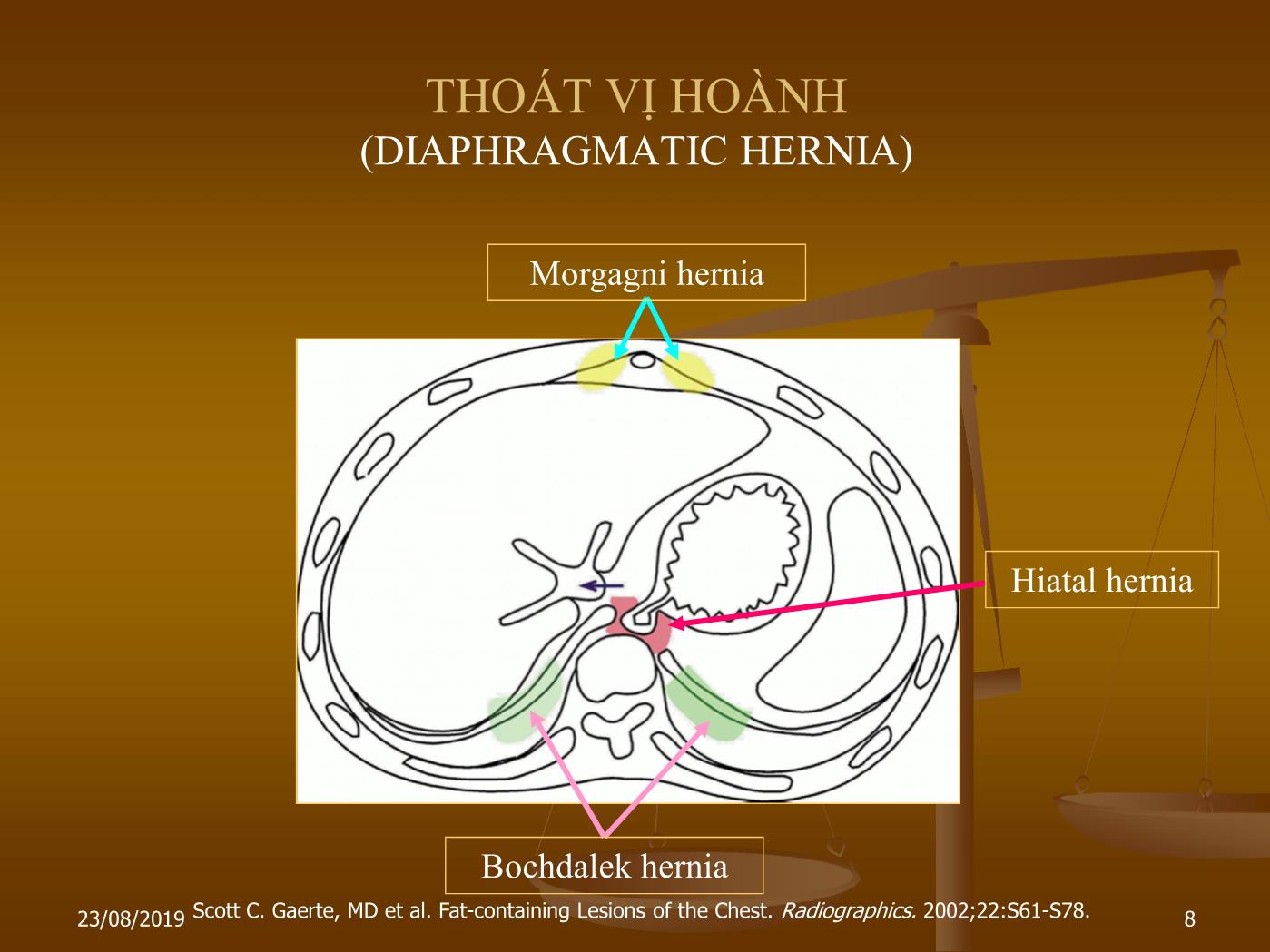 Bài giảng Siêu âm ngực thai nhi - Nguyễn Quang Trọng trang 8