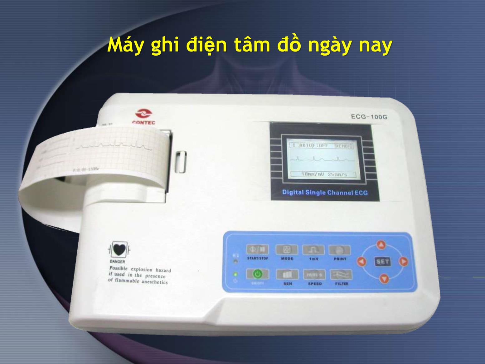 Điện tâm đồ bình thường và một số bệnh lý - Nguyễn Anh Tuấn trang 5