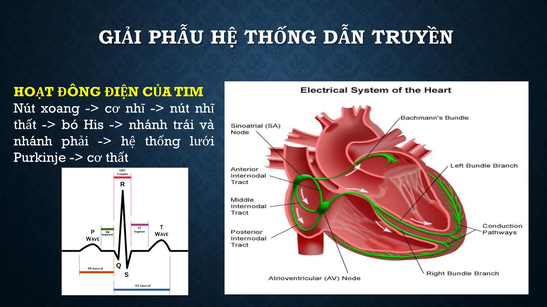 Bài giảng Điện tâm đồ trong rối loạn dẫn truyền tim - Trần Tuấn Việt trang 3