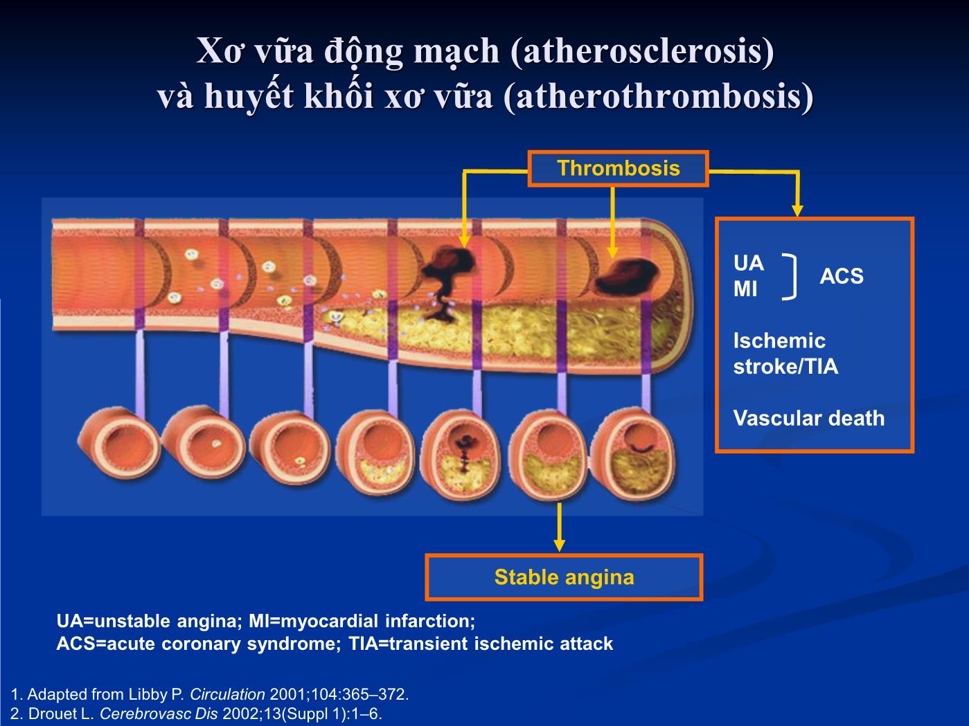 Bài giảng Điều trị chống huyết khối trong các bệnh lý tim mạch - Hồ Huỳnh Quang Trí trang 2