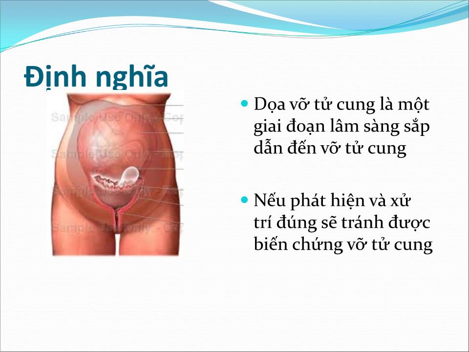 Bài giảng Dọa vỡ - vỡ tử cung - Trần Ngọc Ánh trang 2