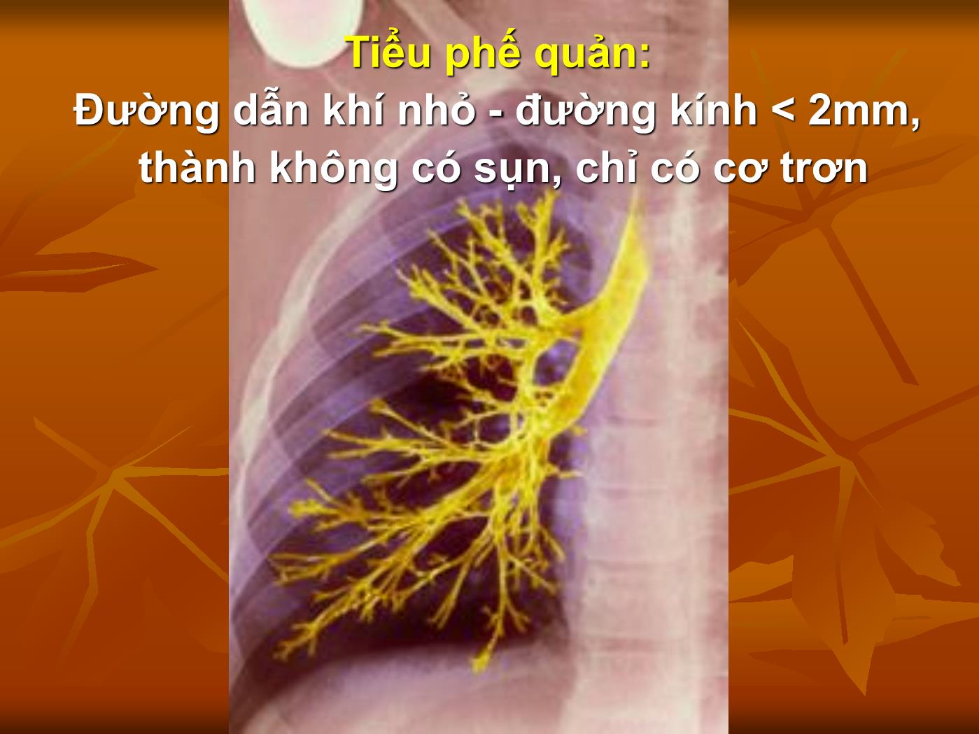 Bài giảng Viêm tiểu phế quản - Trần Anh Tuấn trang 10