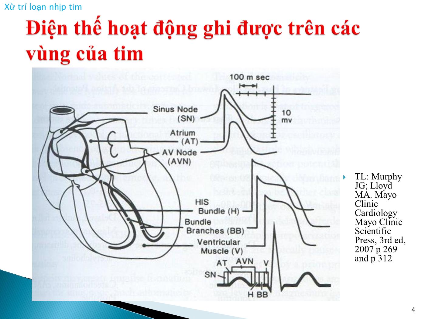 Bài giảng Xử trí loạn nhịp tim - Nguyễn Văn Vinh trang 4