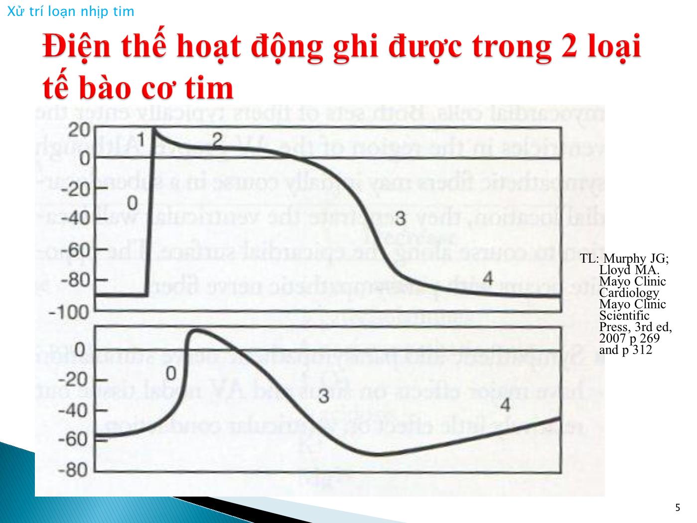 Bài giảng Xử trí loạn nhịp tim - Nguyễn Văn Vinh trang 5