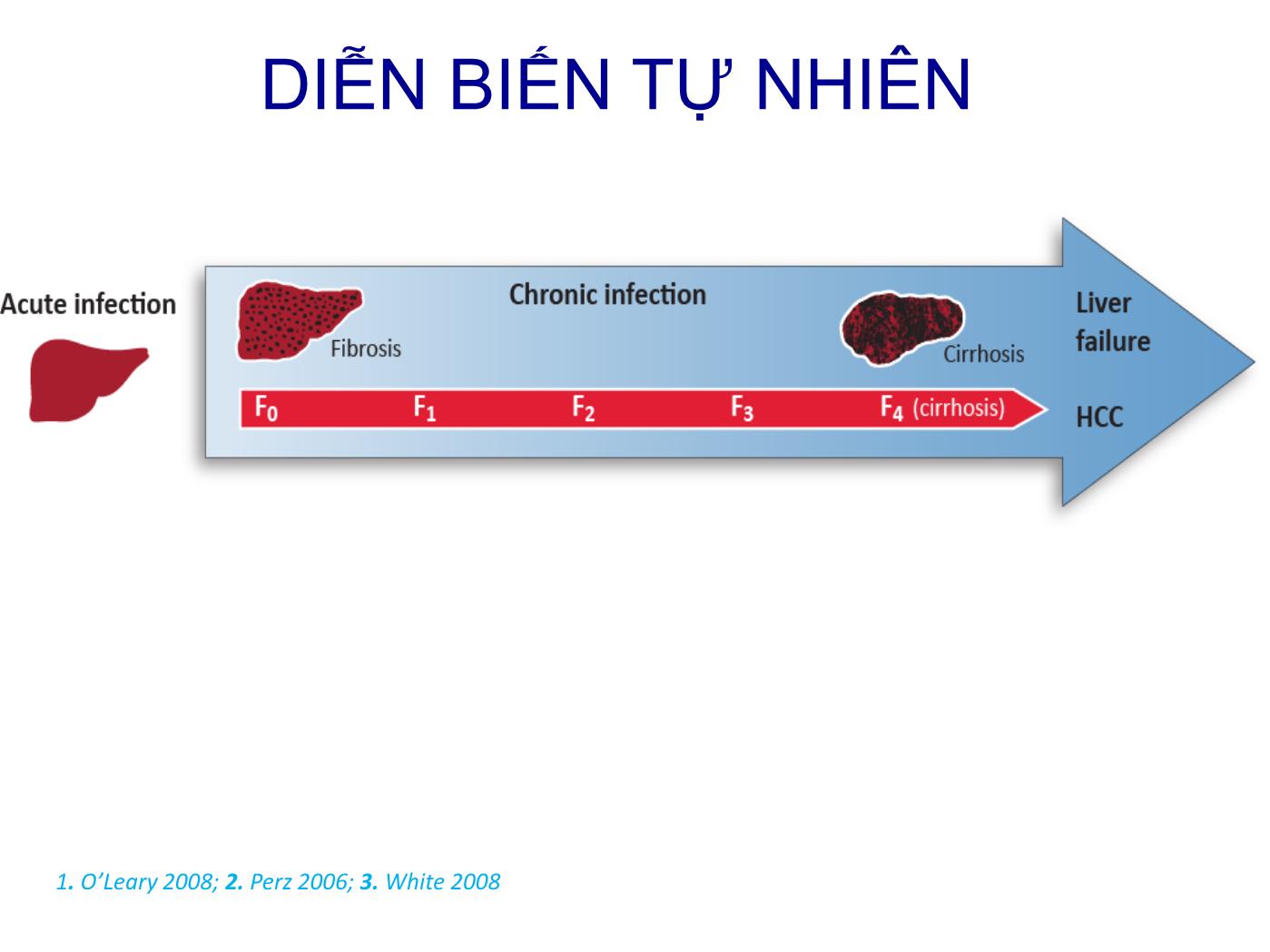 Đề tài Cập nhật điều trị viêm gan virus C mạn năm 2017 - Trần Văn Huy trang 5