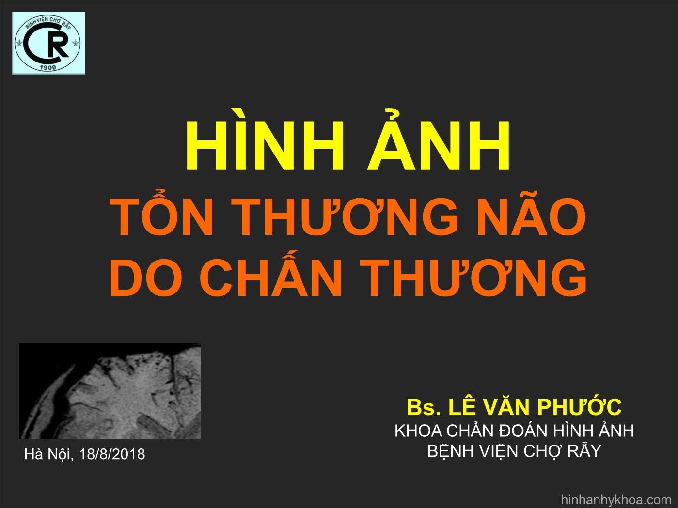 Hình ảnh tổn thương não do chấn thương - Lê Văn Phước trang 1