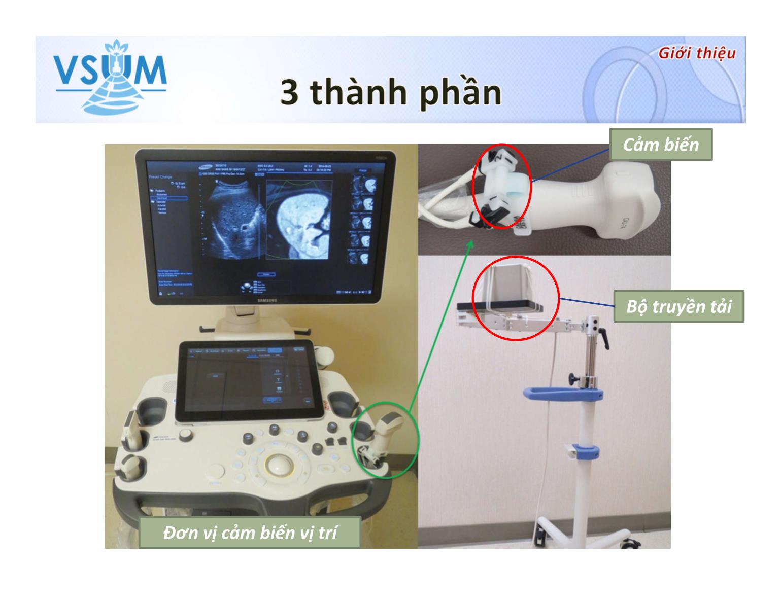 Kĩ thuật kết hợp hình ảnh trong đốt sóng cao tần (RFA) điều trị HCC trang 9