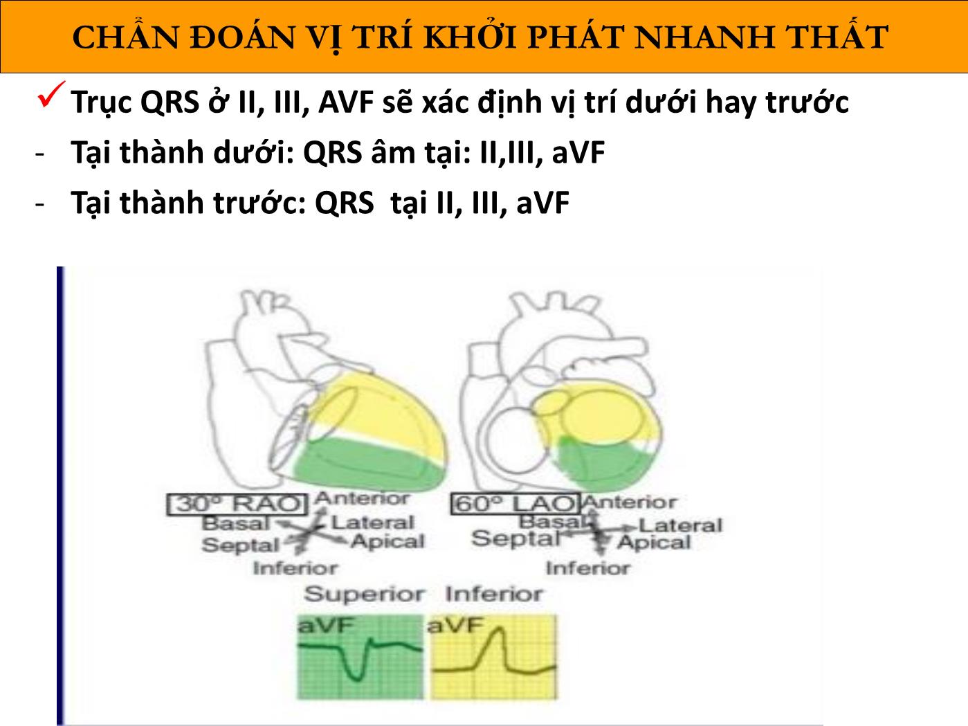 Bài giảng Loạn nhịp thất sau nhồi máu cơ tim - Phạm Trường Sơn trang 10