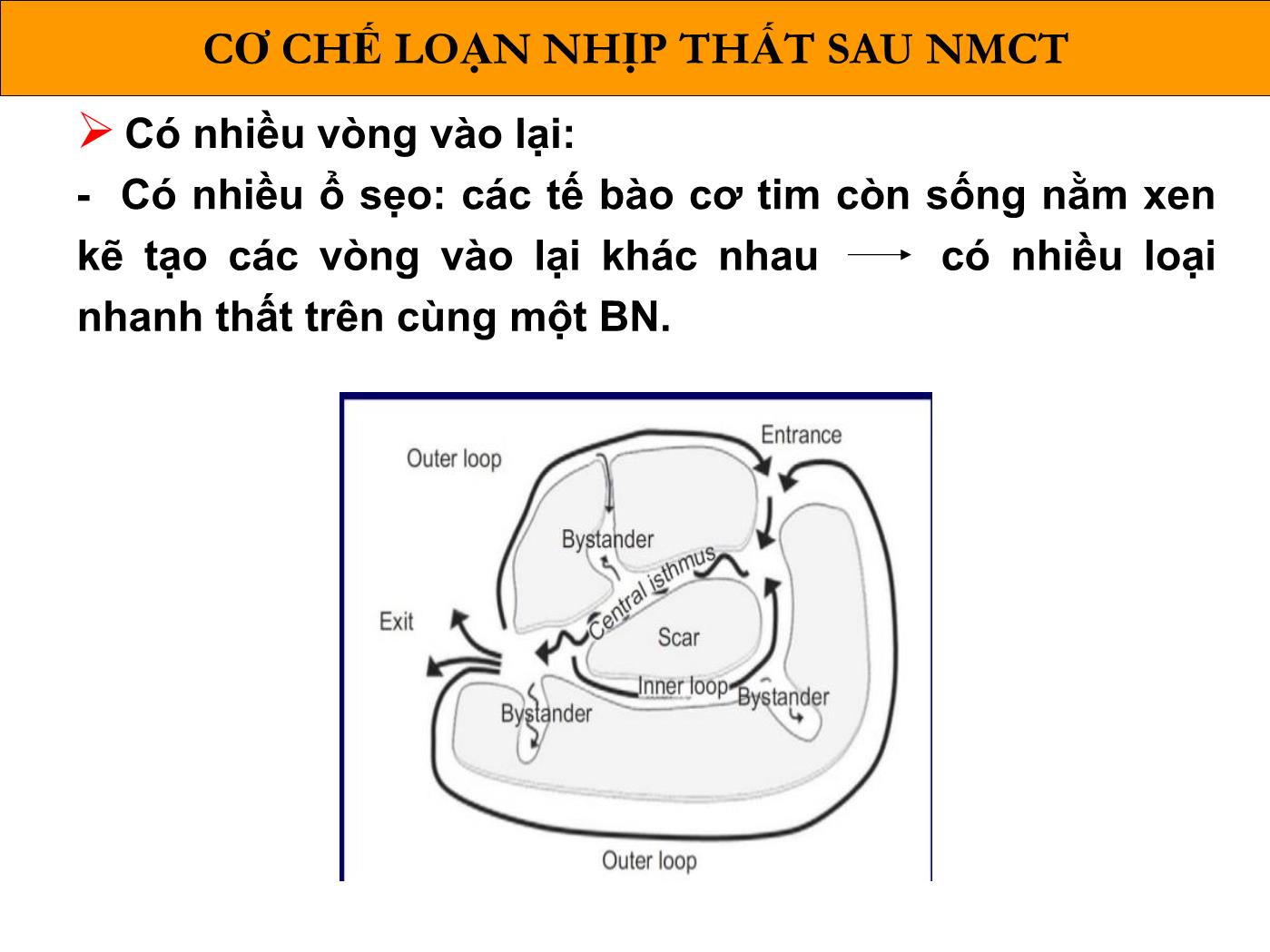 Bài giảng Loạn nhịp thất sau nhồi máu cơ tim - Phạm Trường Sơn trang 6