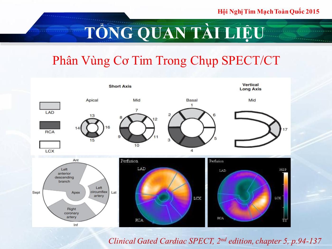 Tương quan giữa nồng độ troponin I và kích thước ổ nhồi máu cơ tim cấp được đánh giá bằng xạ hình tưới máu cơ tim - Lê Thanh Liêm trang 10