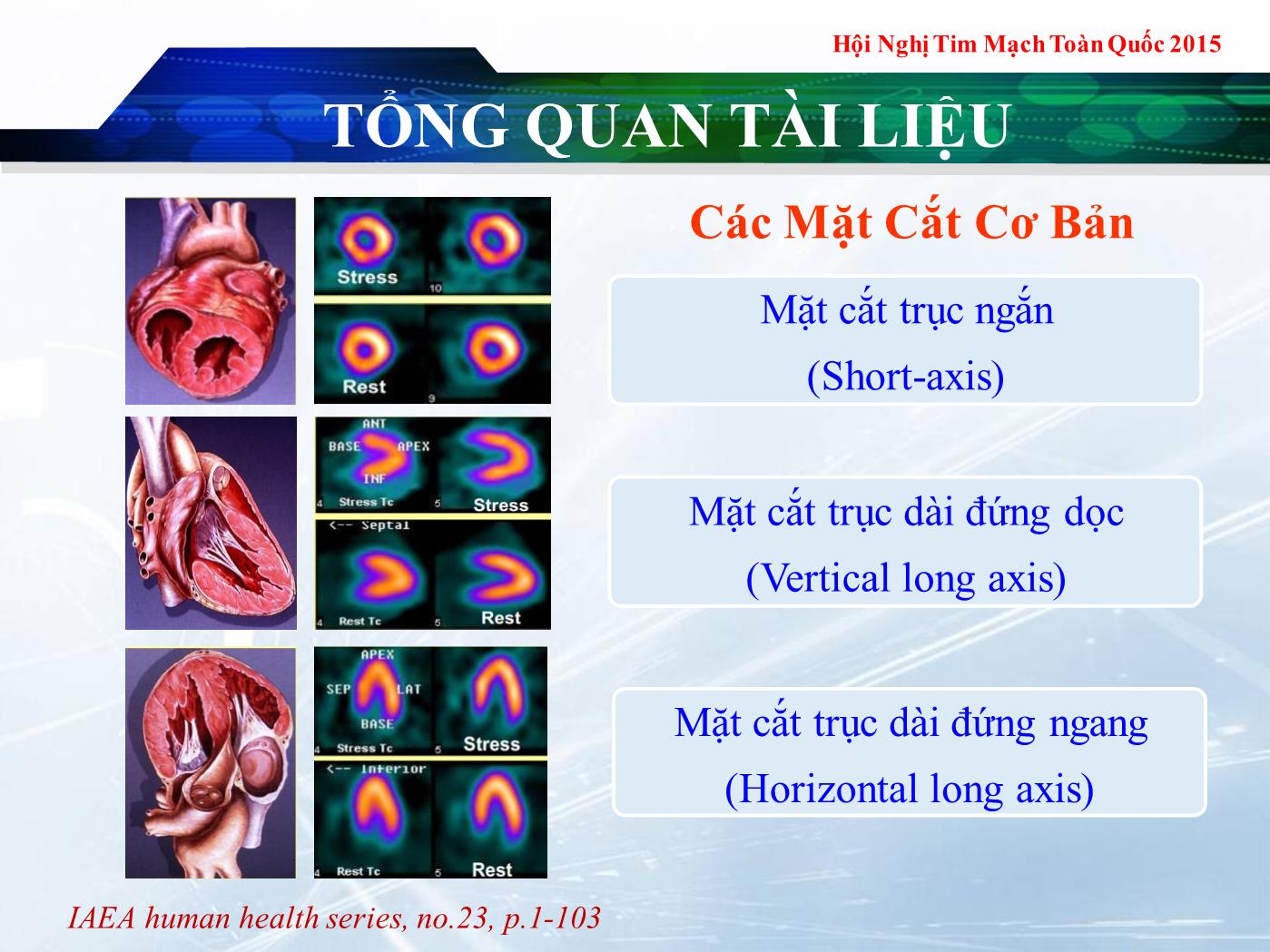 Tương quan giữa nồng độ troponin I và kích thước ổ nhồi máu cơ tim cấp được đánh giá bằng xạ hình tưới máu cơ tim - Lê Thanh Liêm trang 9