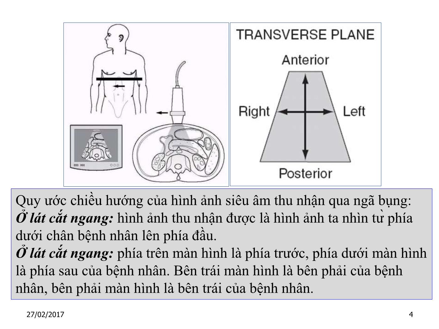 Nguyên lý & kỹ thuật siêu âm doppler - Nguyễn Quang Trọng trang 4