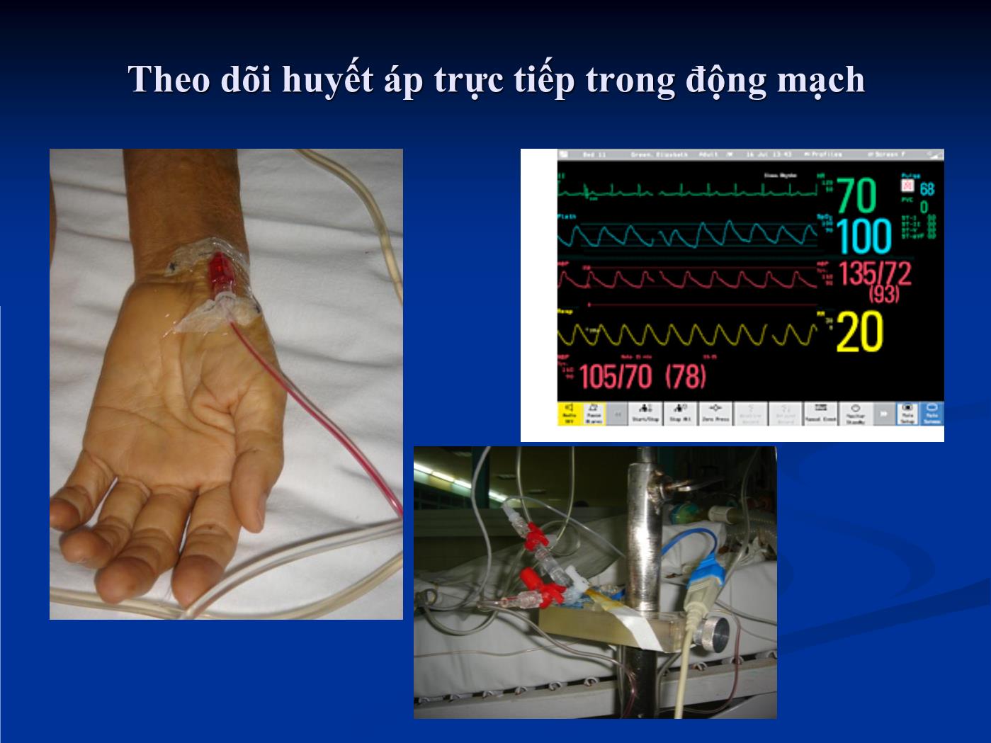 Đề tài Theo dõi huyết động trong hồi sức tim mạch - Hồ Huỳnh Quang Trí trang 8