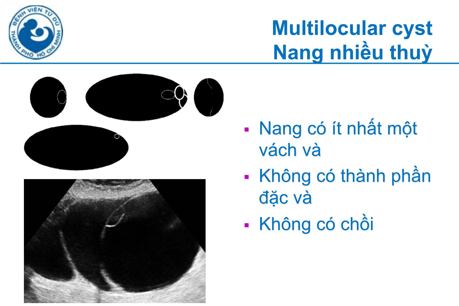 Đề tài Siêu âm đánh giá khối u buồng trứng tính nguy cơ ác tính theo IOTA - Hà Tố Nguyên trang 10