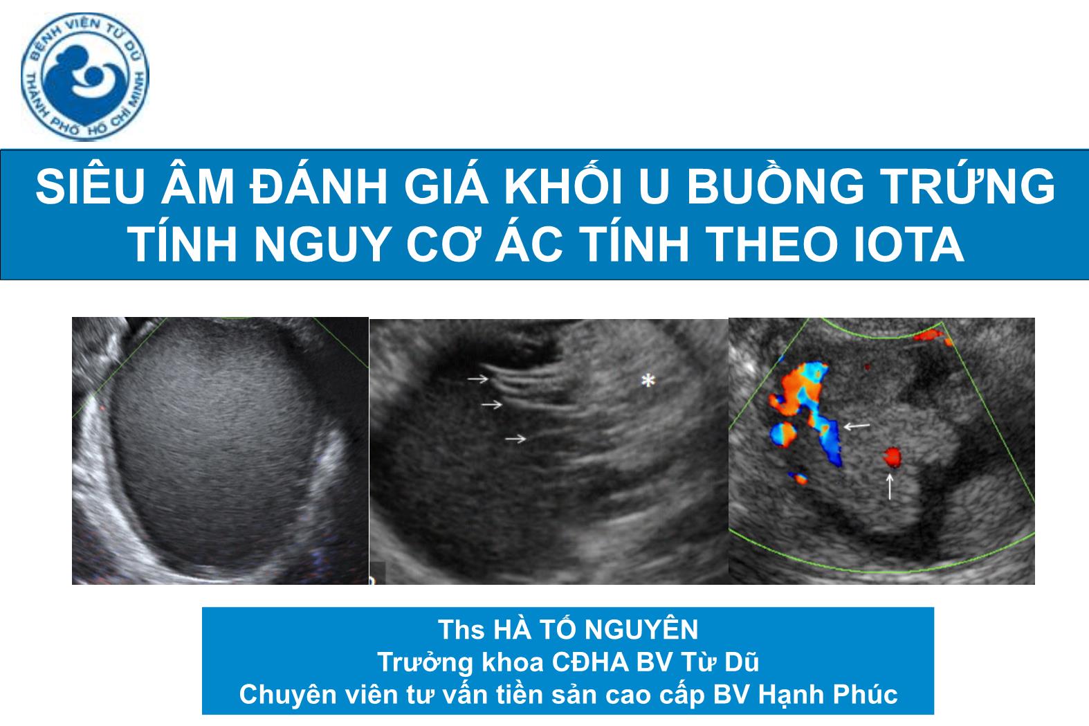 Đề tài Siêu âm đánh giá khối u buồng trứng tính nguy cơ ác tính theo IOTA - Hà Tố Nguyên trang 1