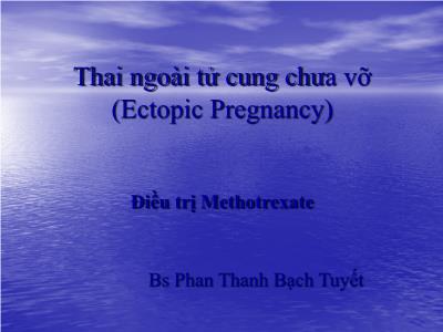 Đề tài Thai ngoài tử cung chưa vỡ - Phan Thanh Bạch Tuyết