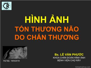 Hình ảnh tổn thương não do chấn thương - Lê Văn Phước